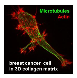 breast cancer cell in 3D collagen matrix