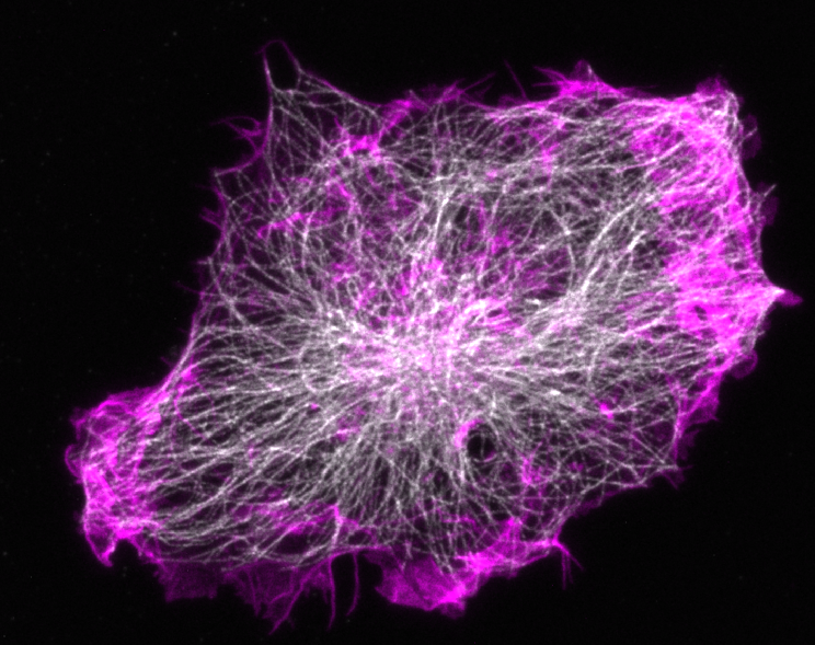 stained actin and microtubules